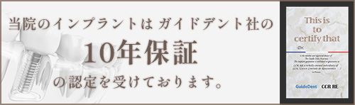 ガイドデント