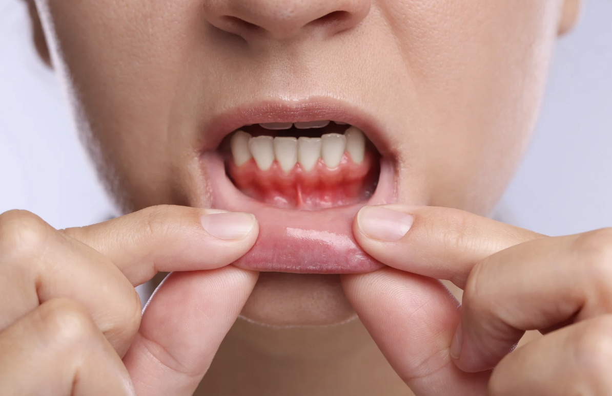 歯茎の白いできものは放置しても大丈夫？変化から考える判断ポイントを解説