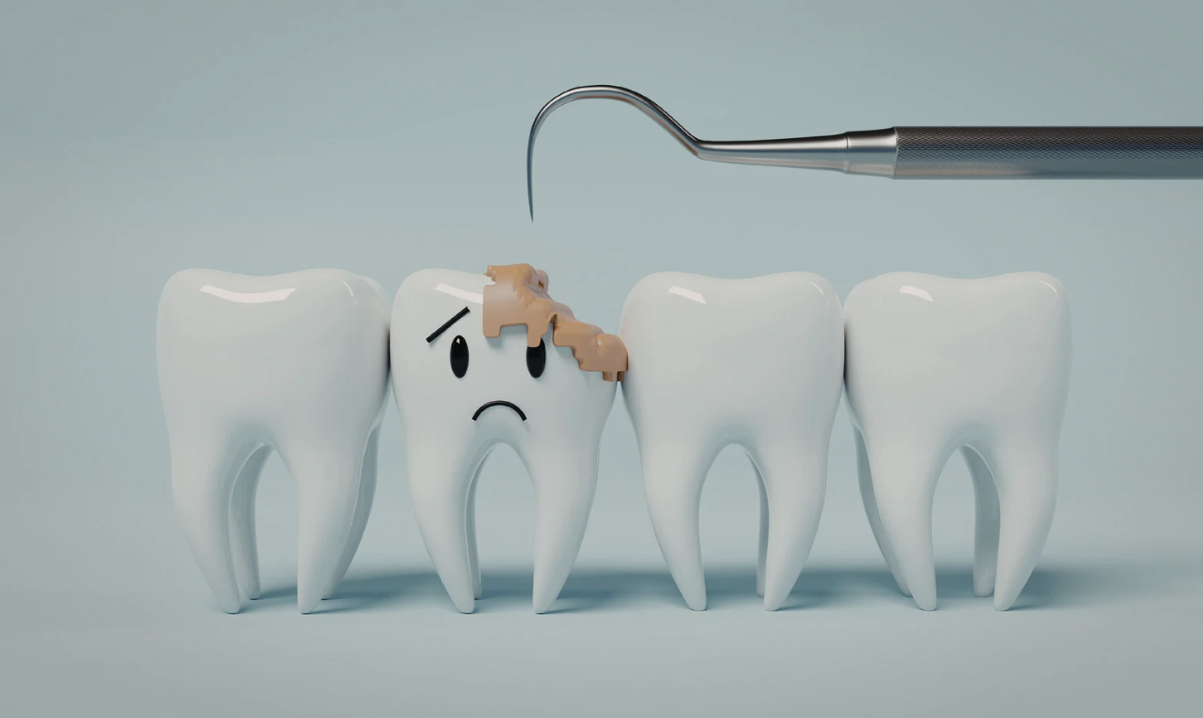 虫歯を放置するとどうなる?見逃されやすい変化と知っておきたい注意点