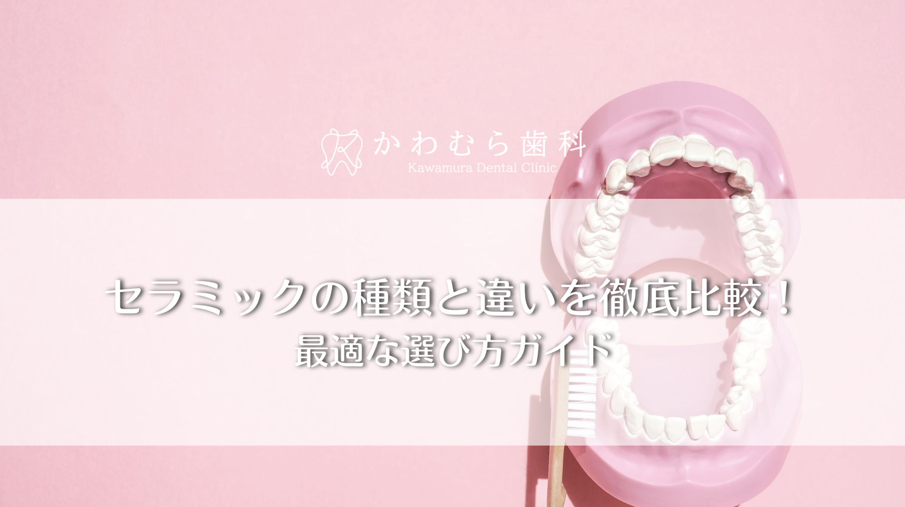 セラミックの種類と違いを徹底比較!最適な選び方ガイド