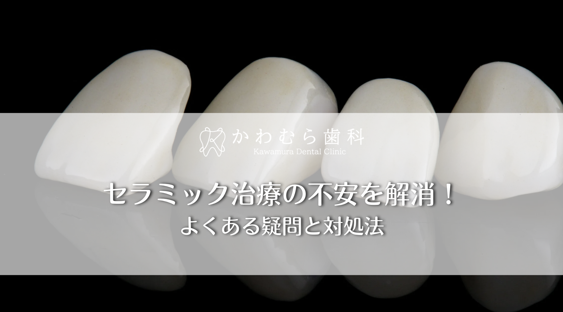 セラミック治療の不安を解消!よくある疑問と対処法