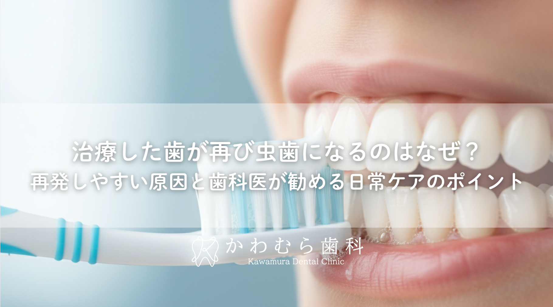治療した歯が再び虫歯になるのはなぜ？再発しやすい原因と歯科医が勧める日常ケアのポイント