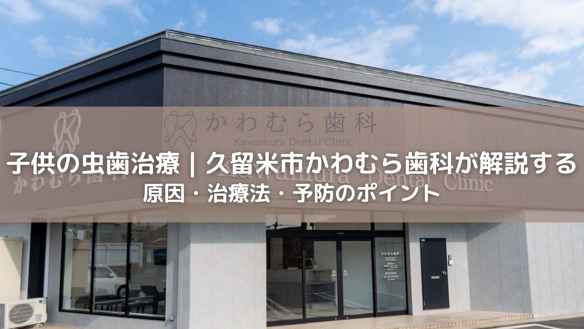 子供の虫歯治療|久留米市かわむら歯科が解説する原因・治療法・予防のポイント